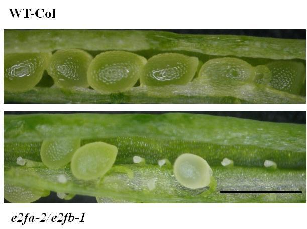 30. ábra: Az e2fa-2/e2fb-1 dupla mutáns részben steril. A képen vad típusú (WT-Col) és e2fa-2/e2fb-1 dupla mutáns növények nyitott becőinek ez a szakasza látható.