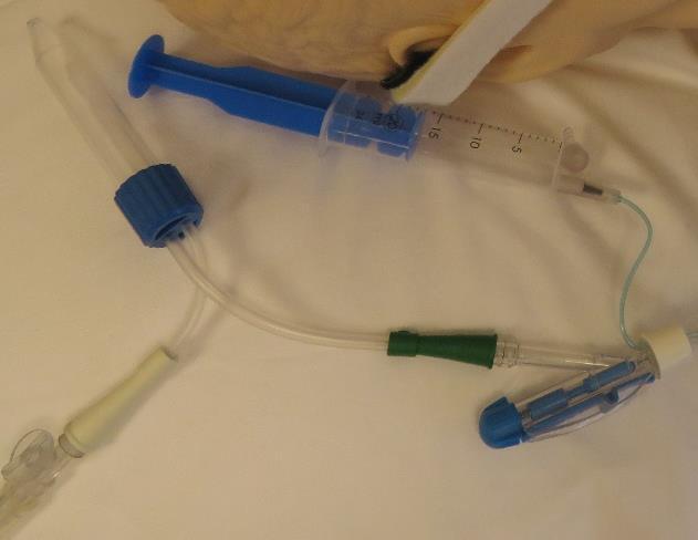 A preanalitikai fázishoz kötött hibák a következők lehetnek: Hemolizált minta Nem megfelelőcsőbe vett minta Kevés minta Bealvadt minta A beteg nem megfelelőelőkészítése (pl.