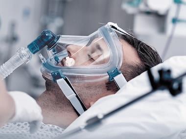 Orotrachealis intubáció Trachea tubus körülbelül 18-22 cm-nél rögzített