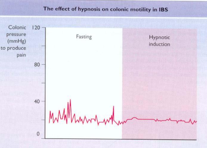 A hypnosis hatása a vastagbél nyomás