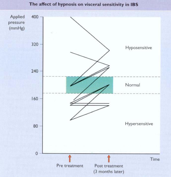 A hypnosis hatása a vastagbél viszcerális érzékenységére