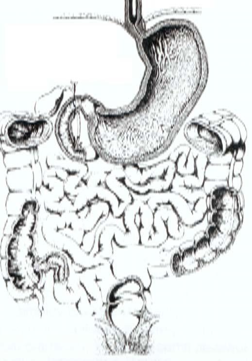 A vékonybél flóra normális megoszlása Gyomor Anaerob - 0 Aerob 10 2-10 Jejunum 3 Anaerob - 0 Aerob 10