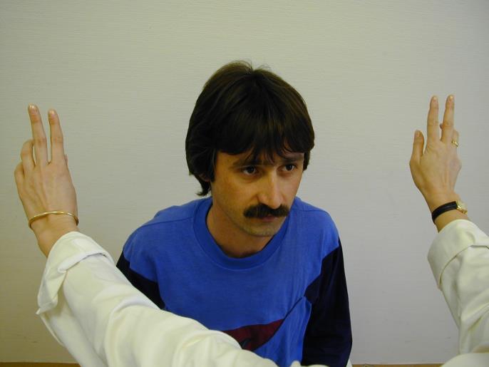 Astereognosis (tactilis agnosia): tárgyakat tapintás alapján nem ismer fel,