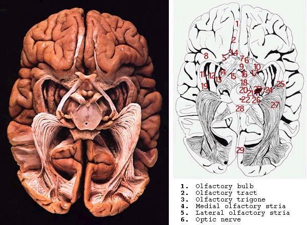 A temporalis lebeny és a látás A radiatio optica (Meyer hurok) károsodása miatt kontralateralis felsőquadráns anopia A kritikus fúziós frekvencia (CFF) emelkedhet.