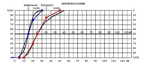 a cochleáris és retrocochlearis régók funkciója és anatómiai viszonyai sokkal jobban feltétrképezhetők. I.5.