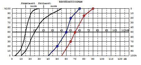 Amennyiben a hangerő növelése ellenére a 100 % -ot nem képes helyesen visszamondani, úgy diszkriminációs veszteség -ről beszélünk.