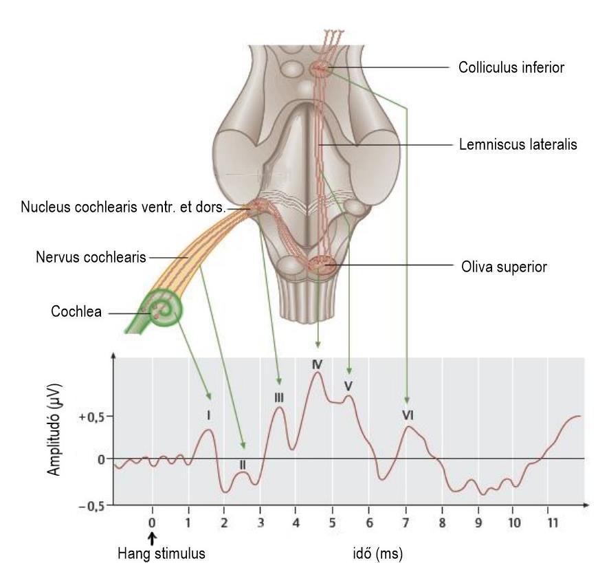 Ábra 7.10. BERA görbe IV.4. Corticalis kiváltott válasz potenciál (Cortical Evoked Response Audiometry /CERA/) További részletek nem a jelenlegi gyakorlatos könyv témája! IV.4.a. Korai kérgi kiváltott potenciál (Mid-Latency Potential /MLR/) További részletek nem a jelenlegi gyakorlatos könyv témája!