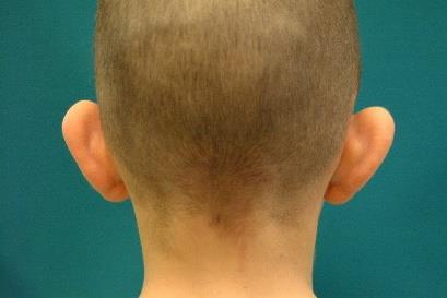 bat ear -