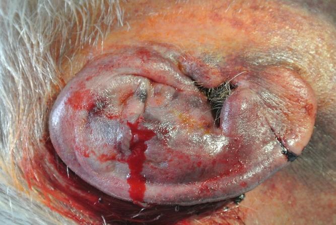 Cleft pinna fülkagyló hasadékos fissura miatt Polyotia szám