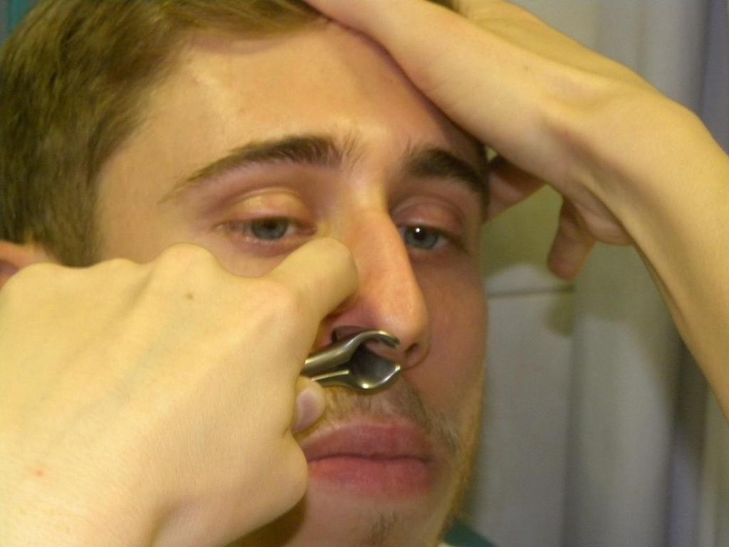 Ábra 2.3. Orrspekulum használata.
