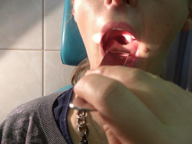 Garat reflex: A n. IX és n. X vizsgálata.