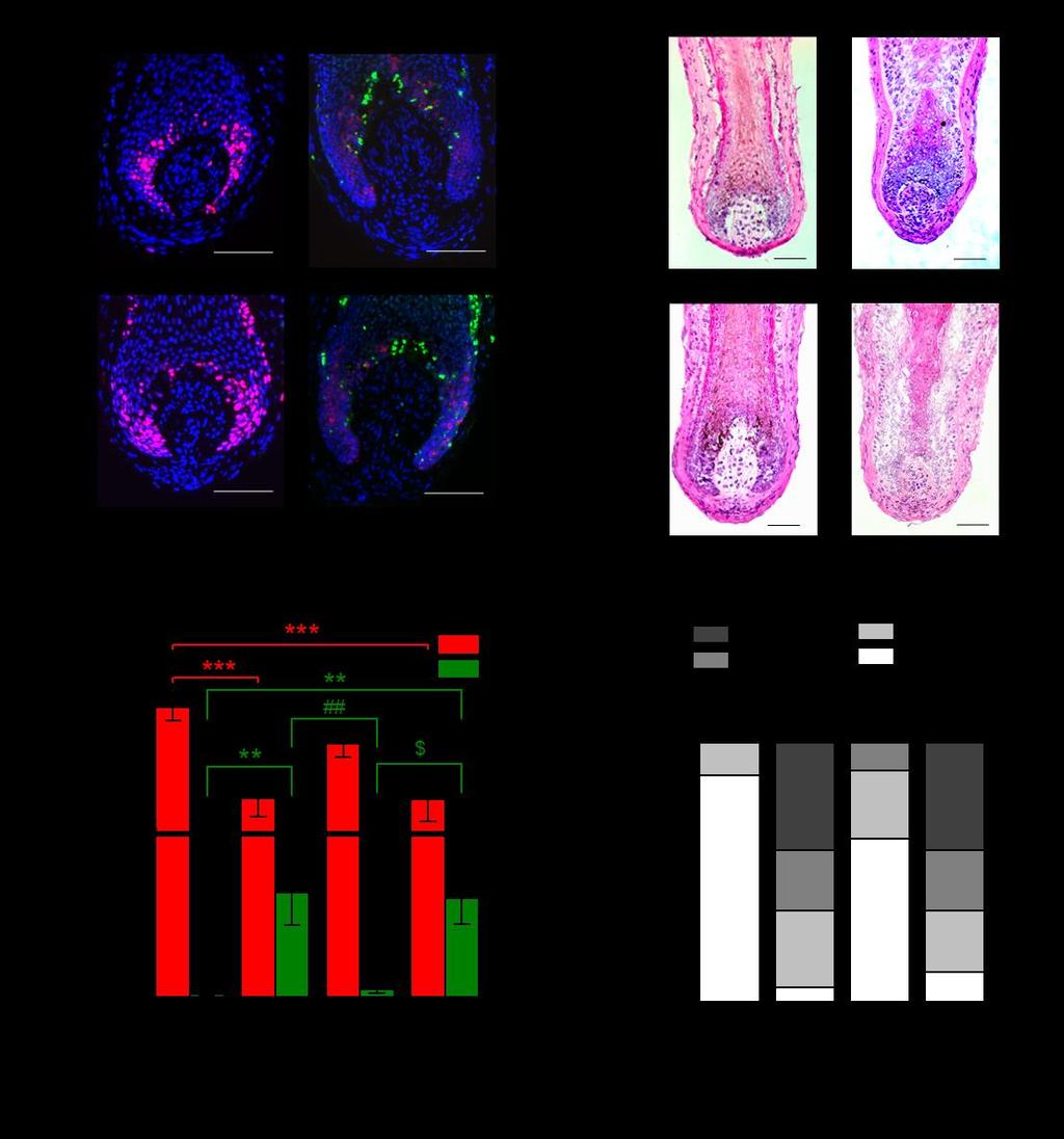 14. ábra: Az adenozin kivédi a TGF-β2 katagén indukáló hatását humán HF-kön. a) Kettős immunjelölés a proliferáló (Ki67+, piros) és apoptotizáló (TUNEL+, zöld) sejtek kimutatására.