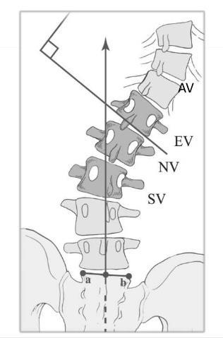 csigolya) EV - End vertebra