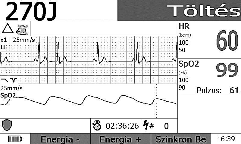 INNOMED MEDICAL ZRT. Cardio-Aid 360-B Bifázisos defibrillátor. Használati  utasítás R V - PDF Free Download