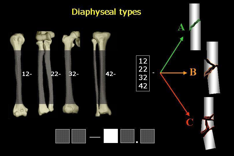 Diaphysis