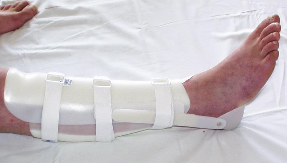 /patellar