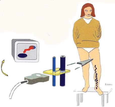 3 viszonyok detektálása, mértékének, pontos helyének és az okot képező eltérések morfológiájának láttatása, célzott kezelést tesz lehetővé.