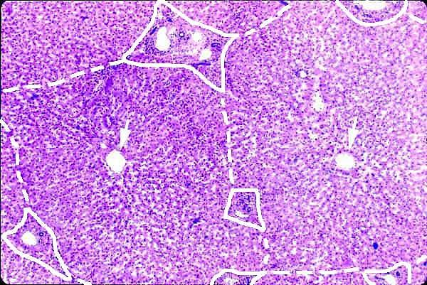 lobulus hepatis A septa