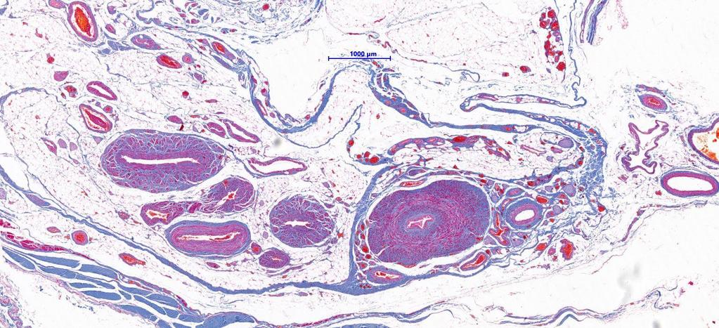 Funiculus