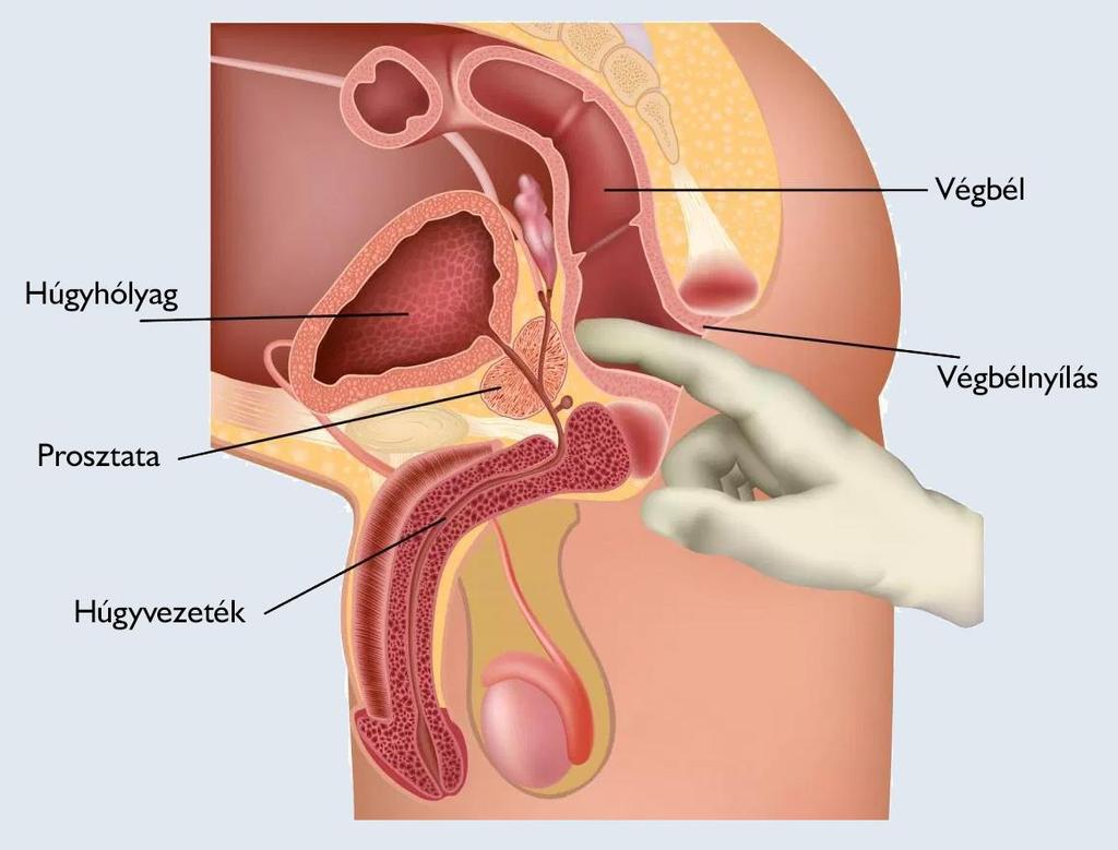 Prostata rectumhoz