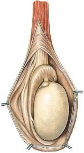 maradványa Appendix epididymidis - a