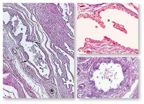 Epididymis mikroszkópos kitekintés 1) (E) Ductuli efferentes testis (száma: