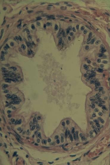 Epididymis