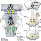 elváltozás: az AGYBAN : ISCHEMIÁS STROKE +/- a LÁTÓPÁLYA rendszerben:ocularis STROKE: retinában < papillában (NA-AION) >>> chiasmában <<