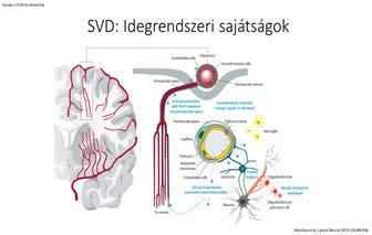 tünet: AMAUROSIS FUGAX 2.