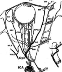 Disease 3./ Artéria OPHTHALMICA: ACI 1.