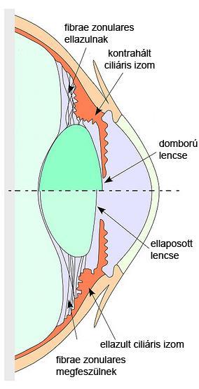 ) m. ciliaris kontrakció (paraszimp.