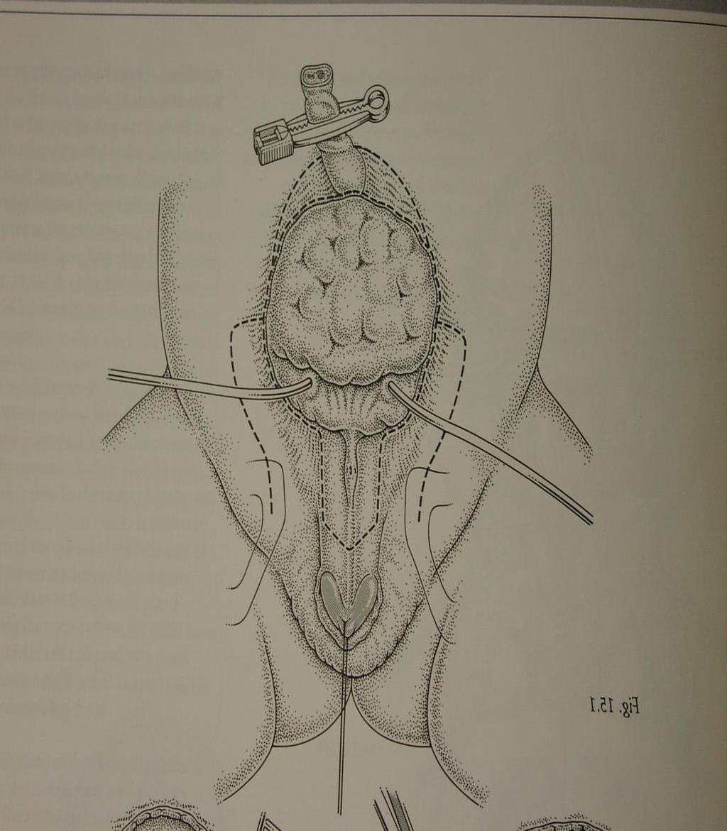 urinariae