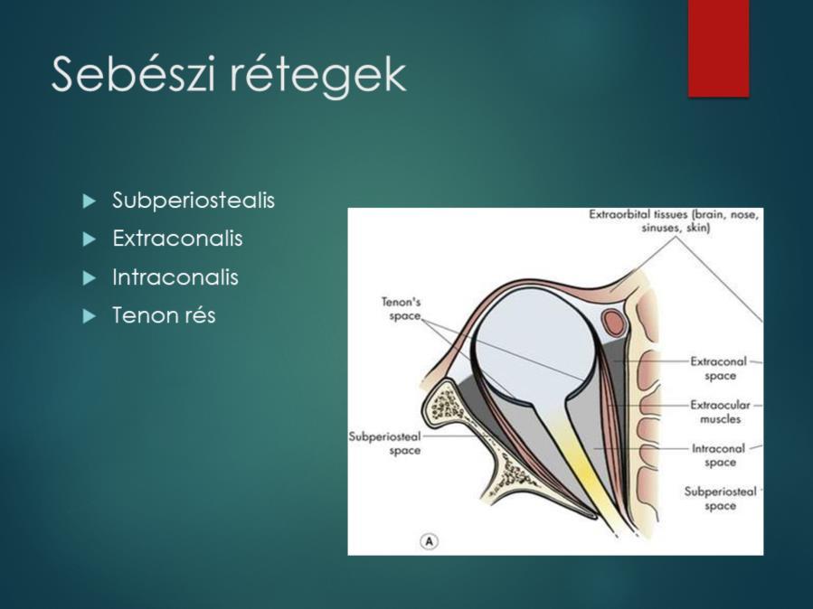Az orbita betegségei többé-kevésbé típusosan a rájuk jellemző rétegekben jelennek meg.