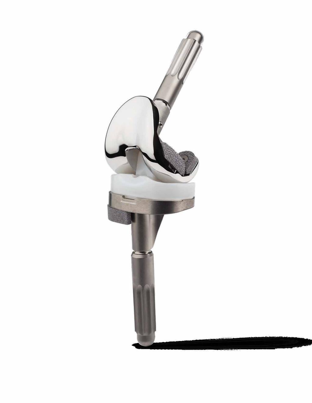 revision knee systems that empower you to offer
