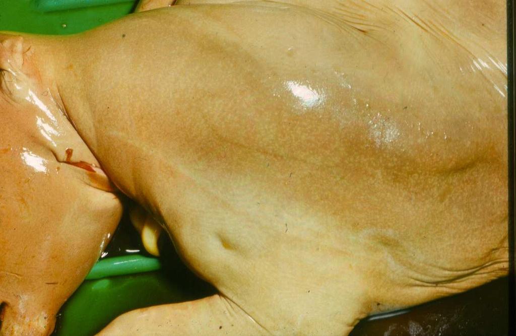 gócok Histophilosis