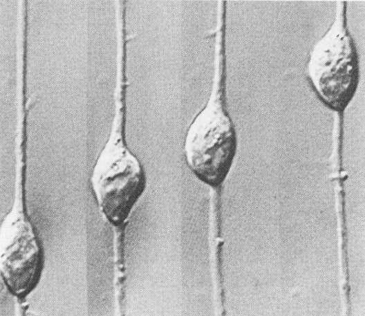 Neuronalis vándorlás glia-sejt nyúlványokon Glialis vezetés: a