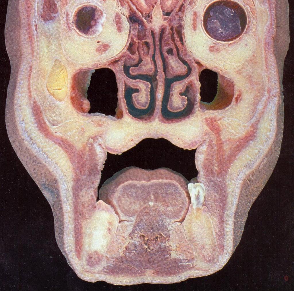 Palatum Bucca Cavum oris proprium Lingua Sulcus