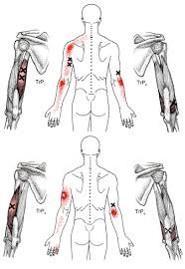 M.Triceps