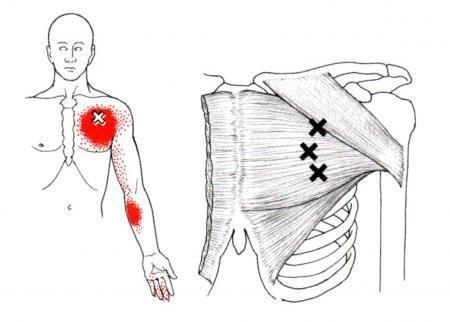 PECTORALIS