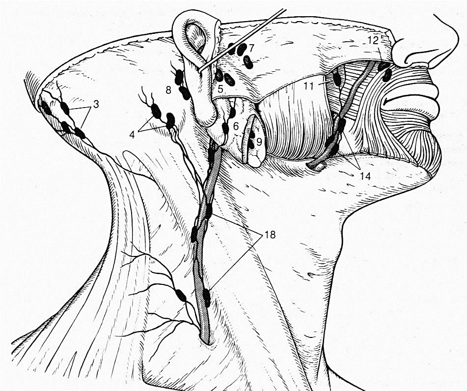 A fej nyirokelvezetése Nodi lymphatici occipitales (3) (fejtető, nyakszirt, mély nyakizmok) Nodi lymphatici mastoidei/retroauriculares (4) (nyakszirt, hallójárat hátsó fala, fülkagyló hátsó része)