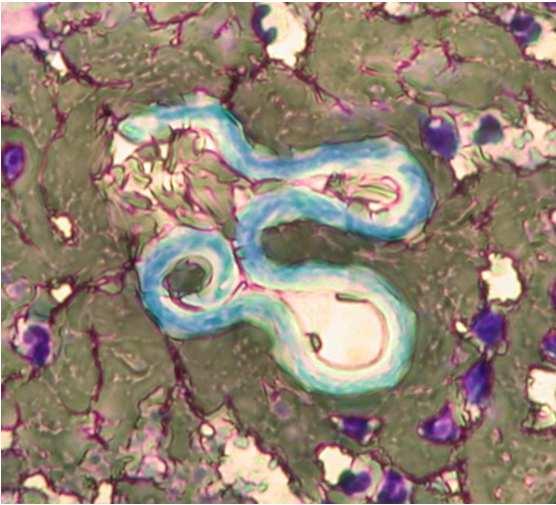 kutya macska mastocytoma Dirofilaria repens