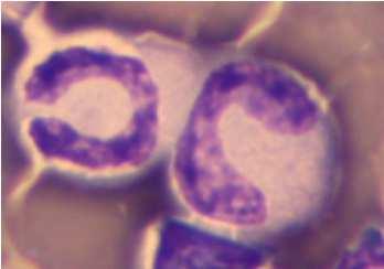 Lymphocytosis Élettani: fiatal kor (neutrophiliásokban), lymphocytás állatok!
