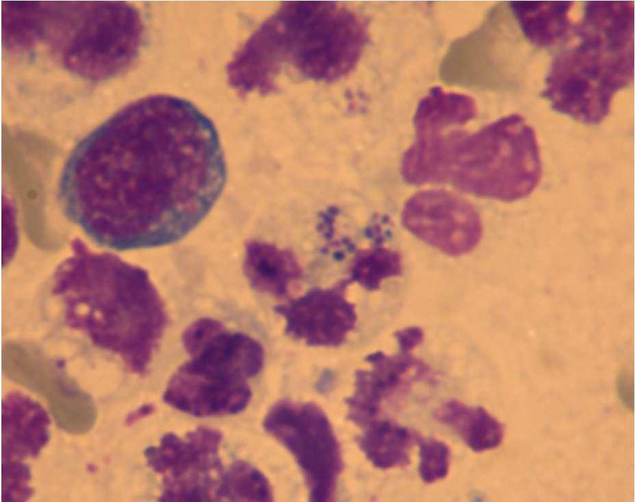 Neutrophil granulocyta: élettartam: vérben néhány óra funkciója: phagocytosis, és