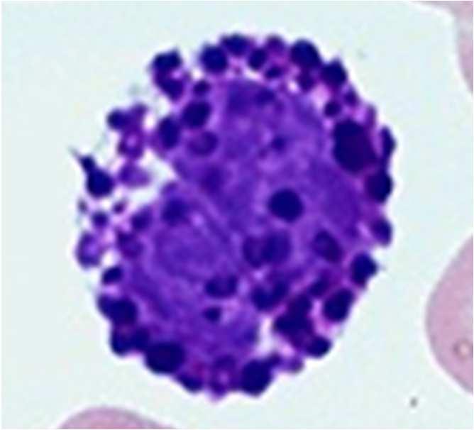 Basophil granulocyta: funkciója: antigénelimináció serkentése, a