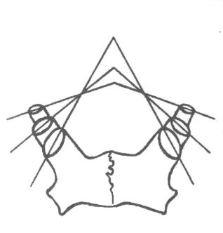 Agancs A levetési síkok metszési szöge alapján (gím és dám) a két koszorú alá illesztett vékony