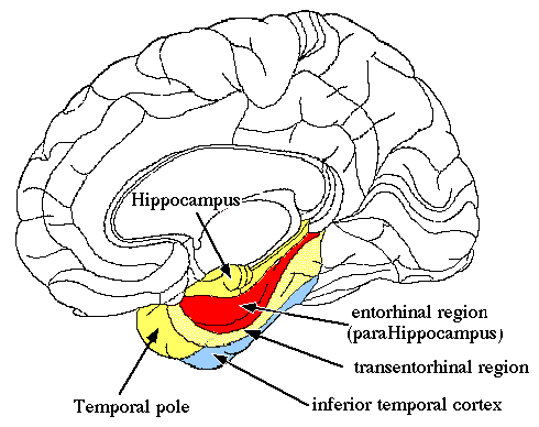Az enyhe kognitív zavar Diagnosztikus értékű a hippocampus mérete Jellegzetes ezen agyi struktúra atrófiája *Neurobiol Aging. 2007 Mar;28(3):398-403.