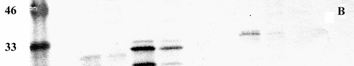 A molekulasúly marker (Prestained Protein Molecular Weight Marker, Fermentas) melletti számok az egyes standard fehérjék molekulasúlyát jelzik kilodaltonban megadva. A: 1. rekc izoforma k 2.