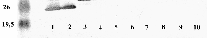 plazmamembrán k, f. B: 1. rekc izoforma k, 2. rekc izoforma m, f 3. B izoforma k 4. B izoforma m, f 5. B izoforma m, 0,1 M NaCl-os mosás, f 6. B izoforma m, 1 M NaCl-os mosás, f 7. A izoforma k, 8.