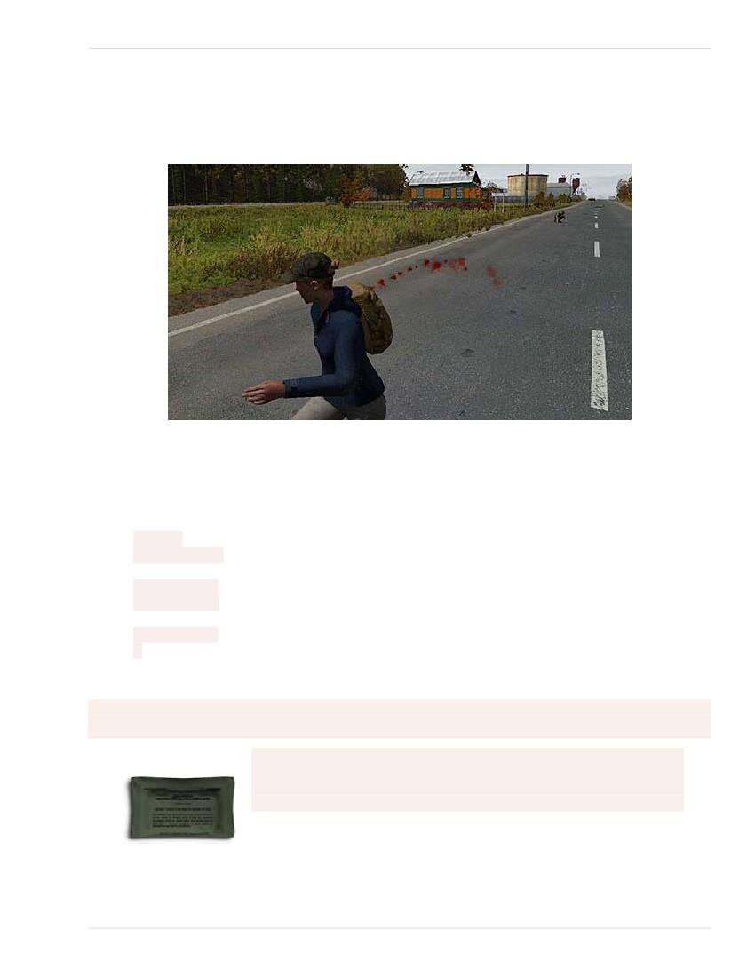 DayZ Game Guide 41 / 119 Vérzés A vér úgy működik, mint a karaktered élete. Az utolsó csepp elvesztése után a karaktered meghal.