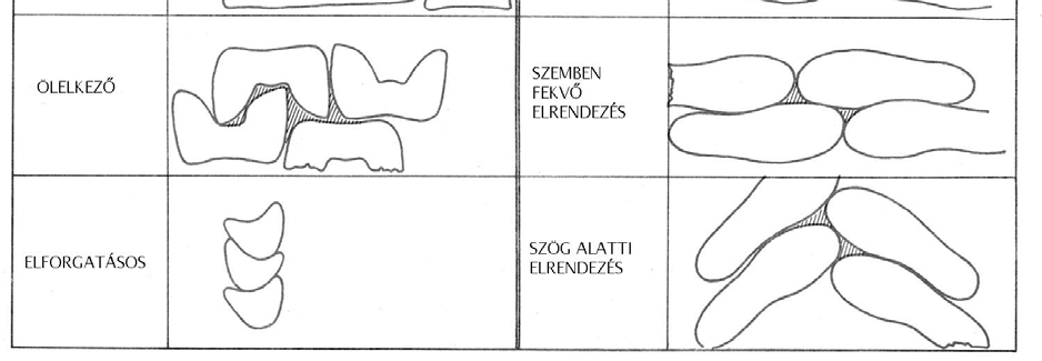 megtervezése. A felfektetési rajz változatainak tervezésekor számítások alapján dönthető el, melyik változatban a legkisebb a sajátos hulladék területe.